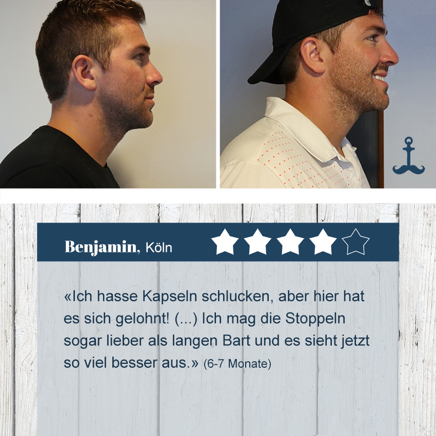 Florians Bartwuchsmittel Test 4