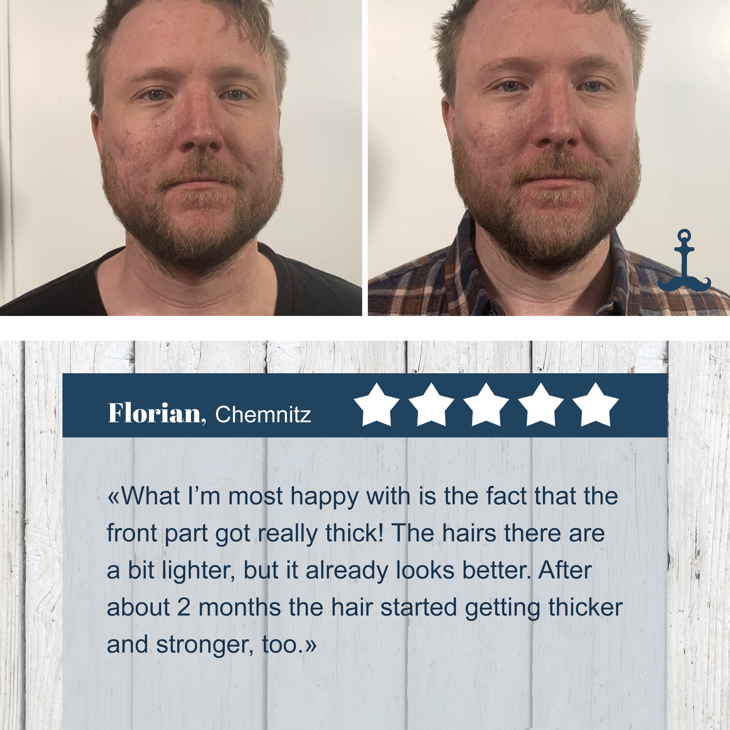 Florians Bartwuchsmittel Test 4