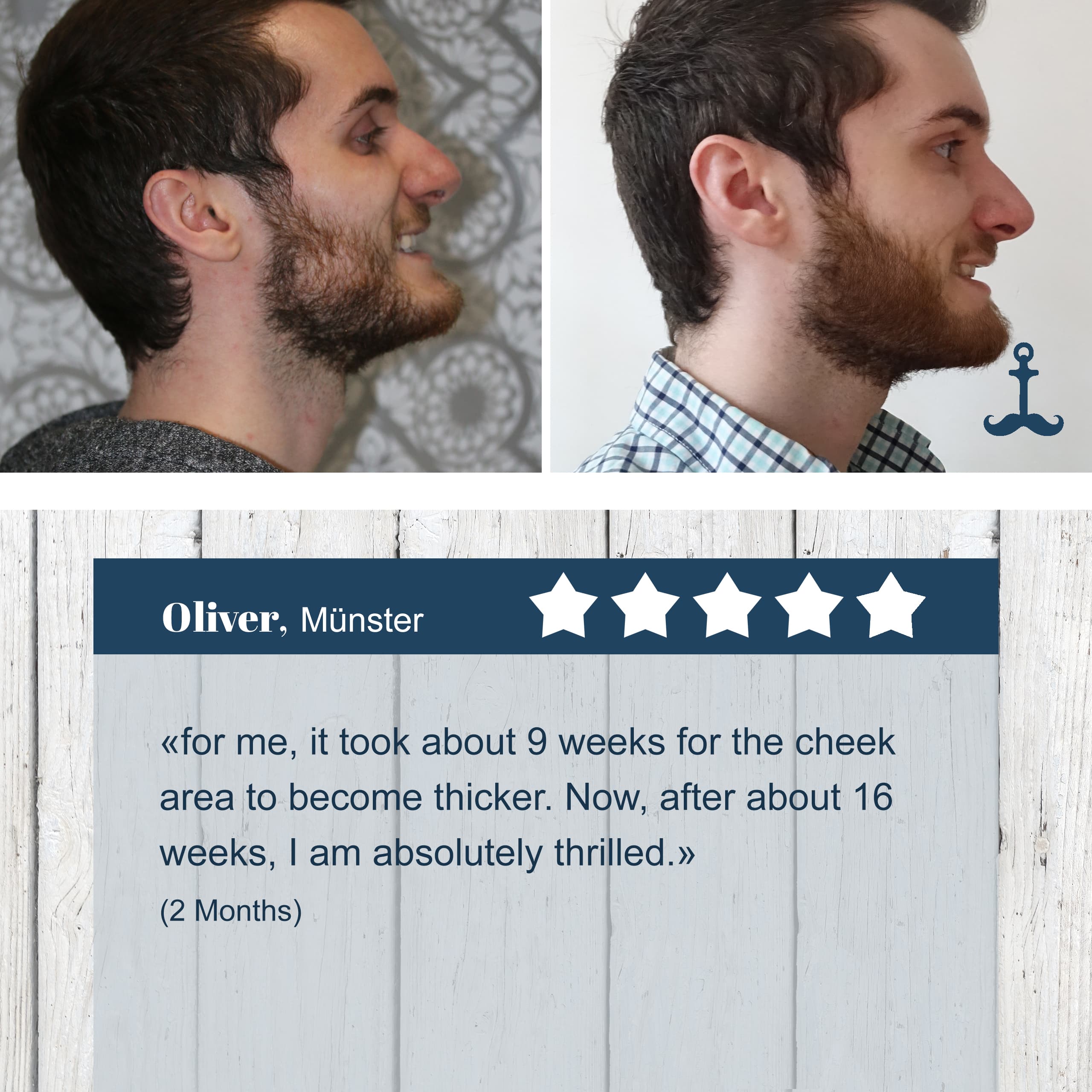 Joe‘s Finest Erfahrungsbilder Vorher- Nachher 5