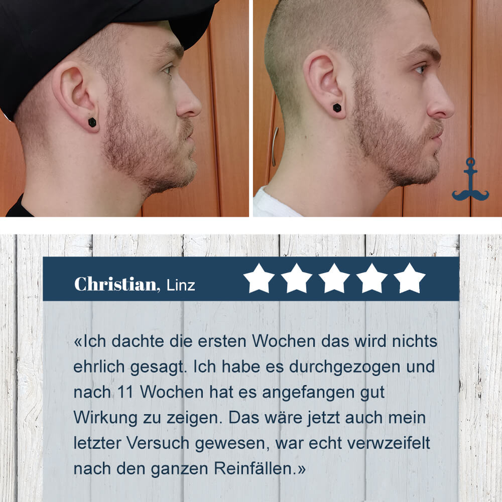 Joe‘s Finest Erfahrungsbilder Vorher- Nachher 5