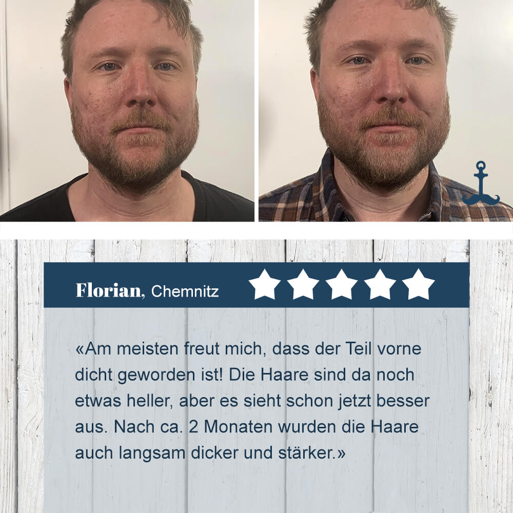 Florians Bartwuchsmittel Test 4